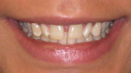 Before